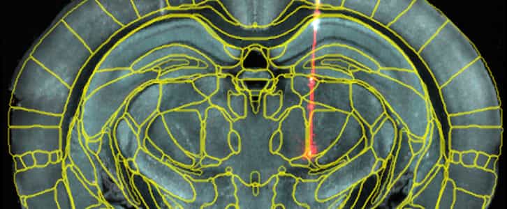Dye-labelled electrode track in a mouse coronal section with overlaid Allen CCF borders