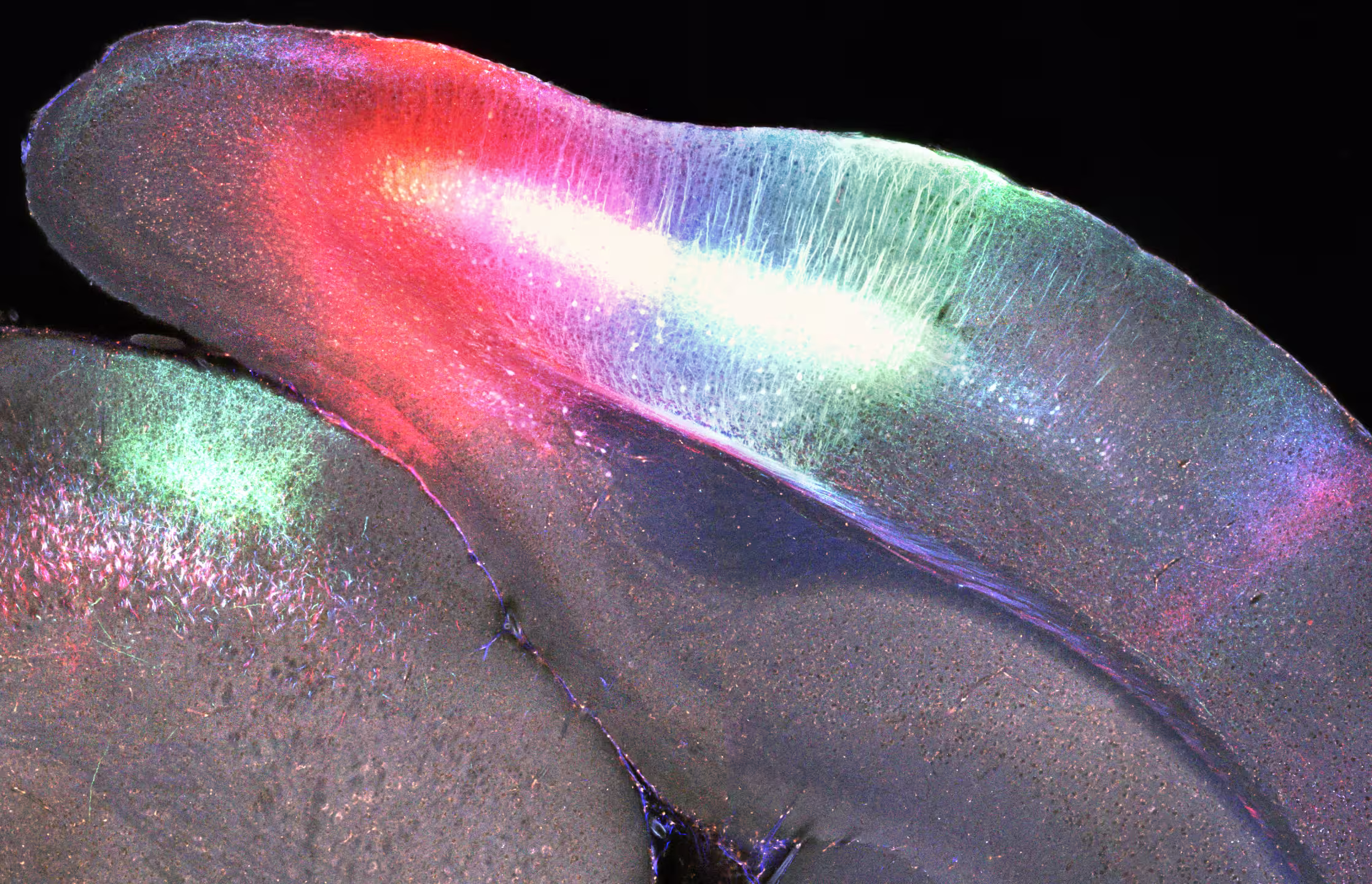 multicolour tracer injections mouse cortex