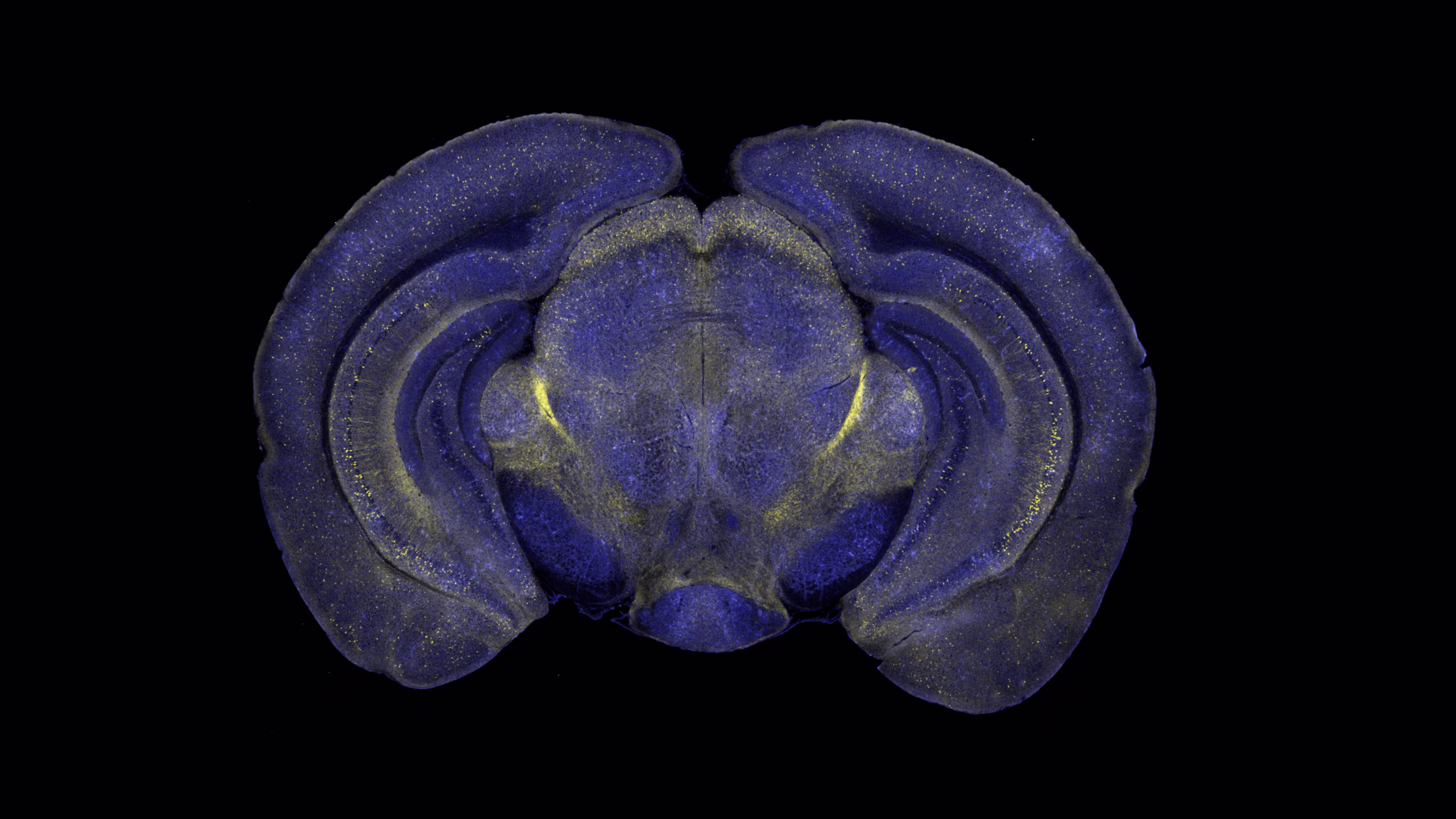 mouse brain coronal section